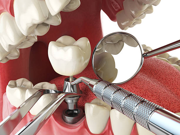 Best Emergency Cosmetic Dentistry in Greenville, GA